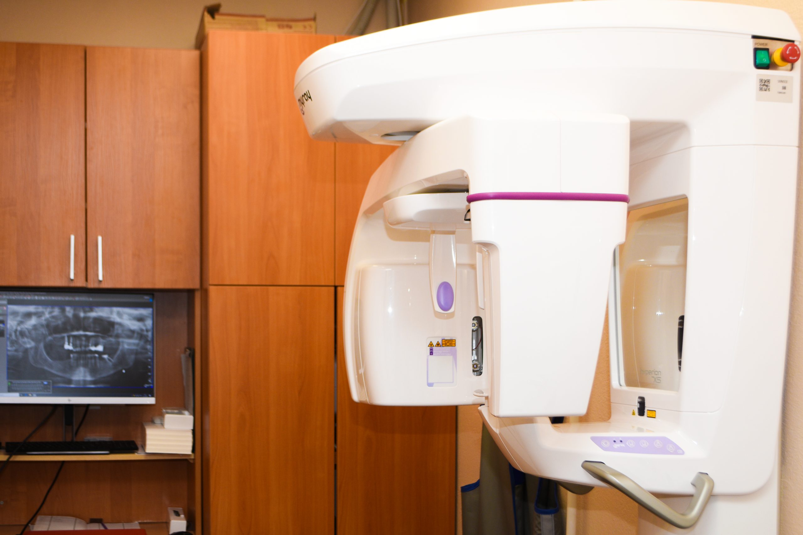 Panoraminio rentgeno aparatas diagnostikai